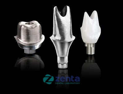 CUSTOM ABUTMENT 1