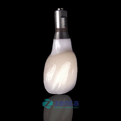 Implant2 1
