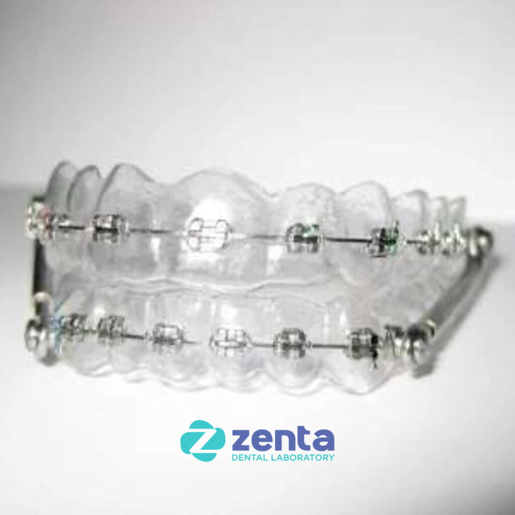 Retainer 1