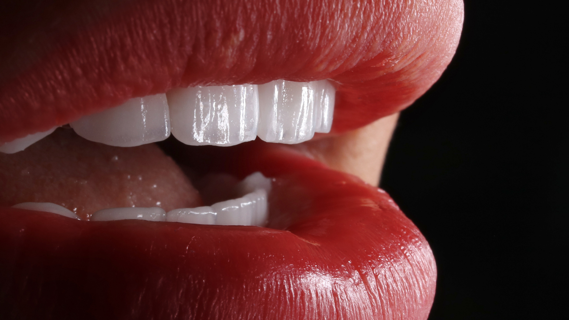 feldspathic veneers the ultimate guide 667d3d7aeb342